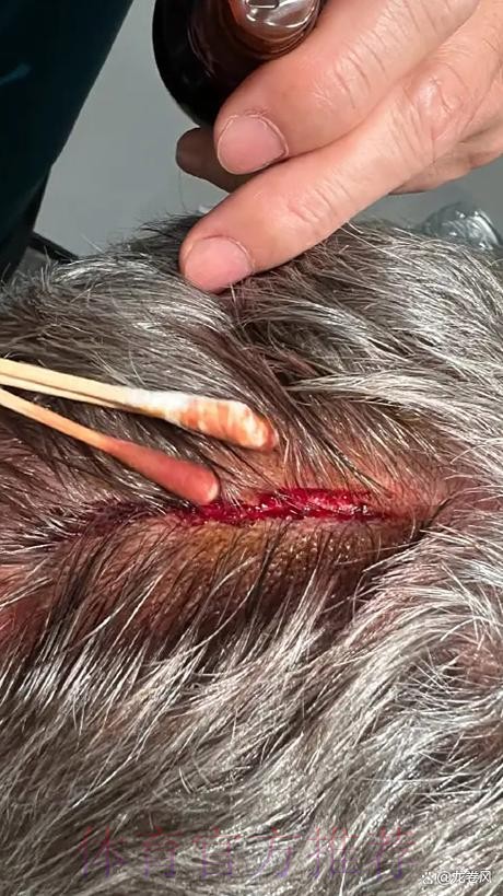 安帅:输球责任在我 马竞领先2球让一切都变得困难 安帅:输球责任在我 马竞领先2球让一切都变得困难